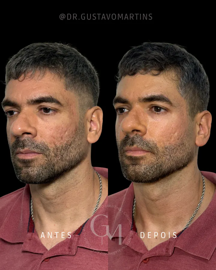 Método NaturalUp® · paciente 1