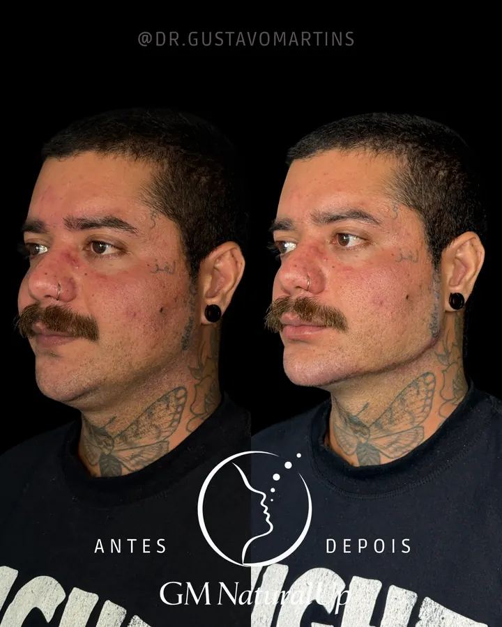 Método NaturalUp® · paciente 6