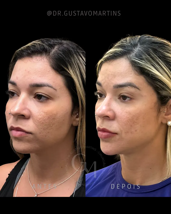Método NaturalUp® · paciente 7