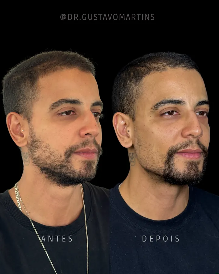 Método NaturalUp® · paciente 8