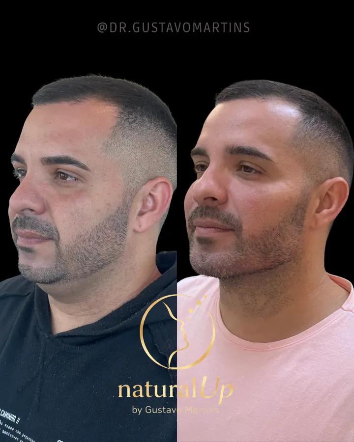 Método NaturalUp® · paciente 9