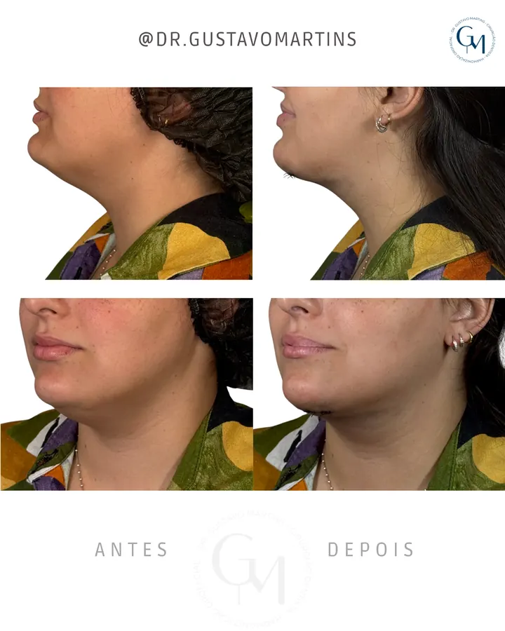 Método NaturalUp® · paciente 12