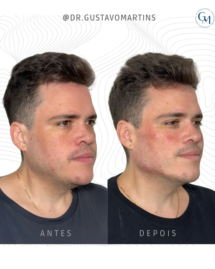 Método NaturalUp® · paciente 19