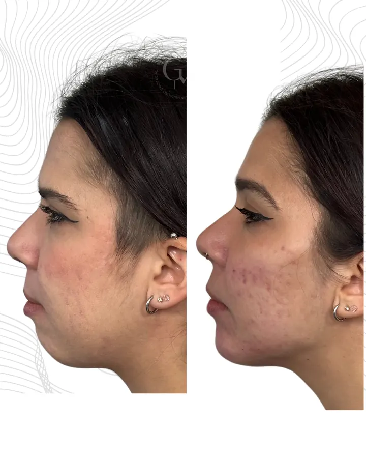 Método NaturalUp® · paciente 24