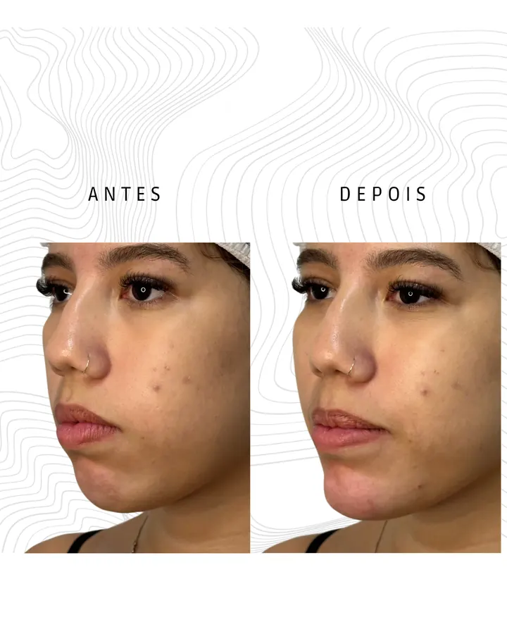 Método NaturalUp® · paciente 25