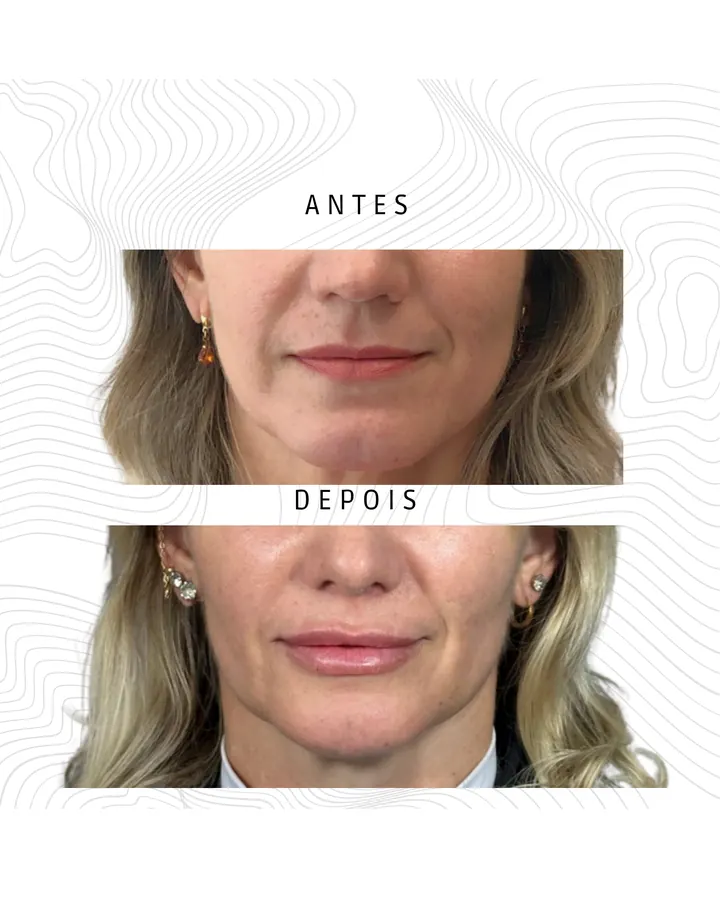 Método NaturalUp® · paciente 26